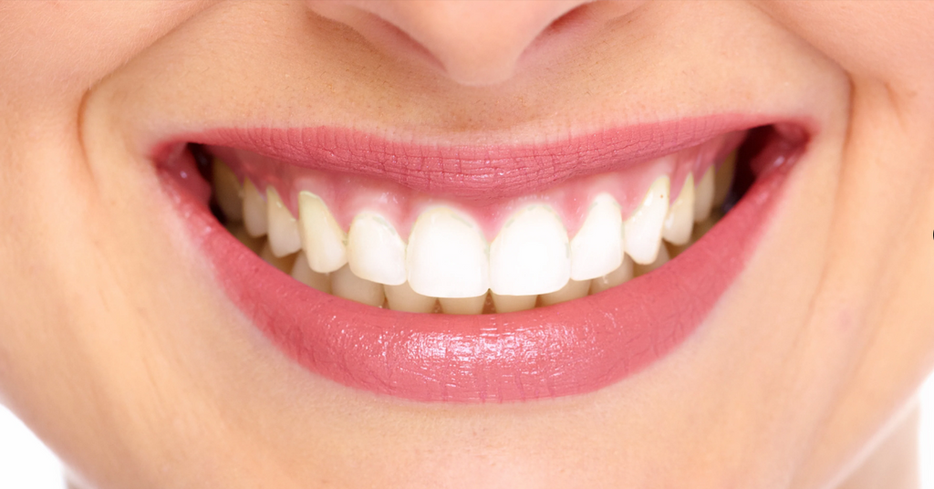 Aerivax Sonic Toothbrush before treatment - teeth and gum appearance before consistent use